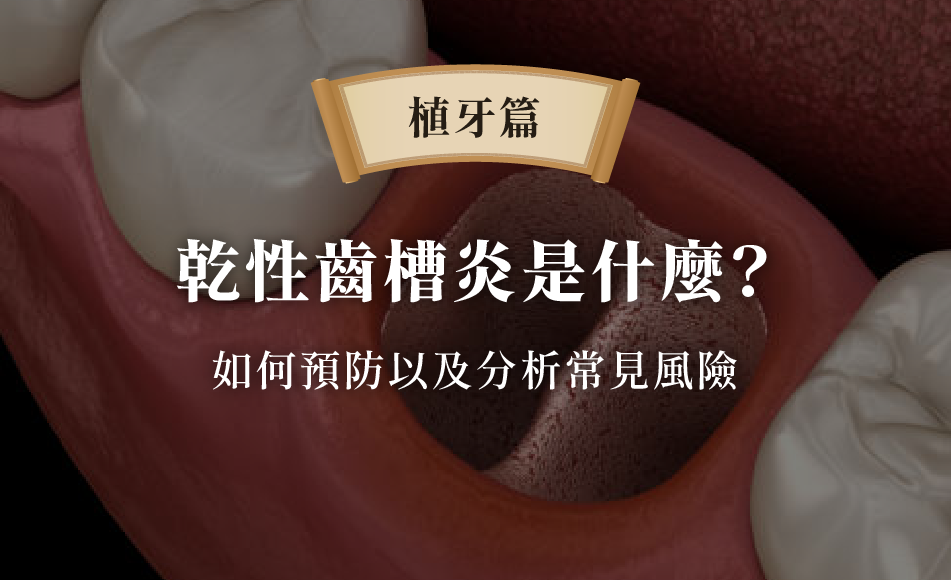 乾性齒槽炎是什麼?預防與常見4症狀