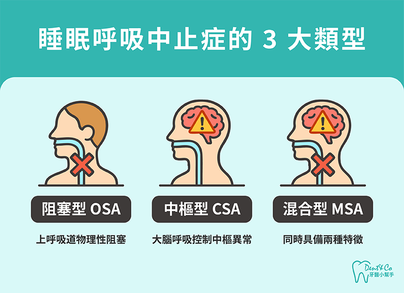 250822_部落格文章_打呼與睡眠呼吸中止症的差別是什麼?原因、症狀與風險一次看懂_內文圖片-2.png