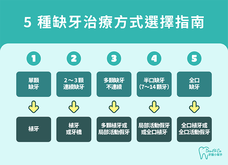 5種缺牙治療方式選擇指南。