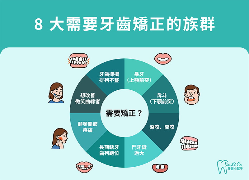 8大需要牙齒矯正的族群。