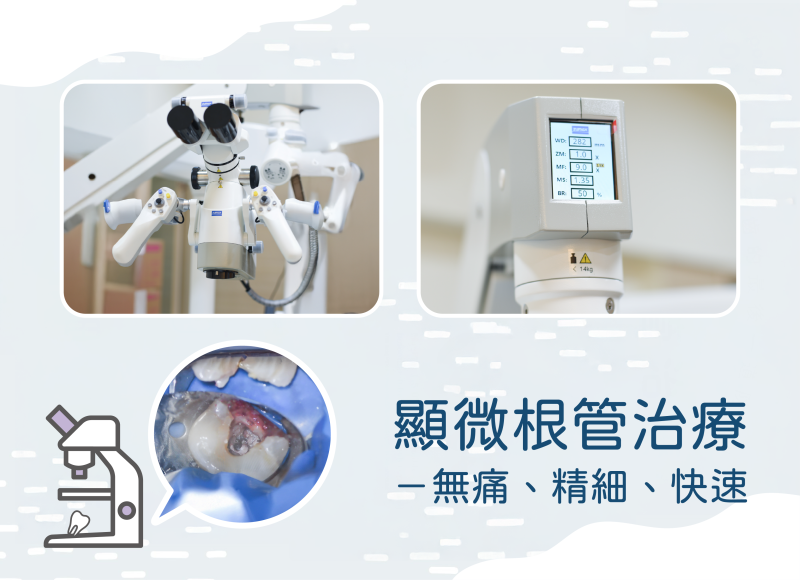 251118_部落格文章_好好牙醫開箱文_顯微根管治療.png