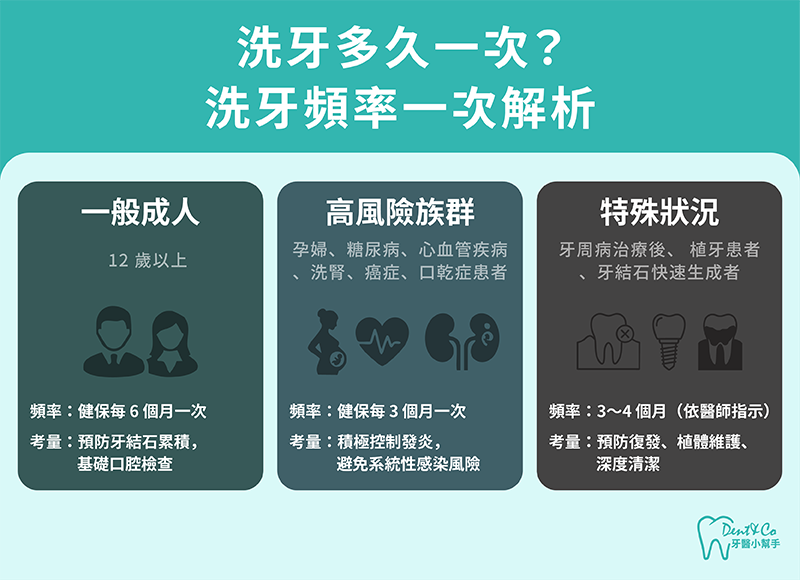 洗牙多久一次?洗牙頻率一次解析