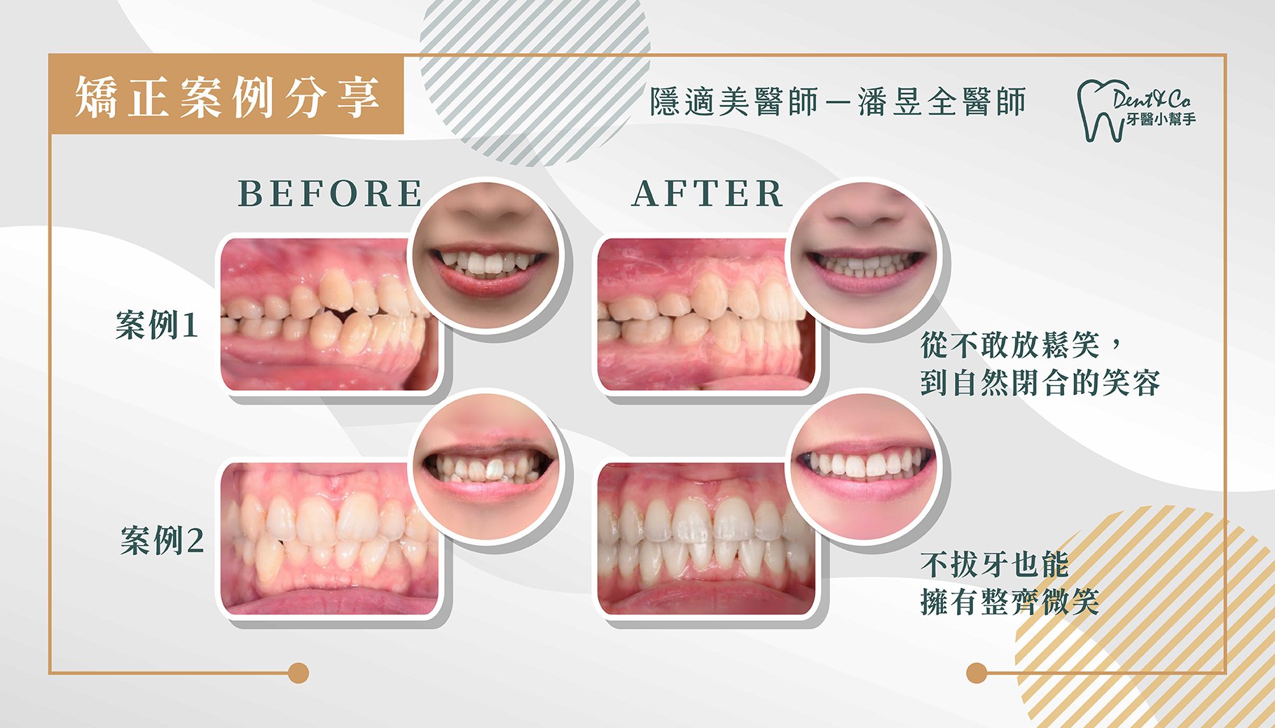 260525_矯正醫師文章_潘昱全_03.jpg