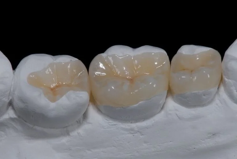 3D齒雕.webp