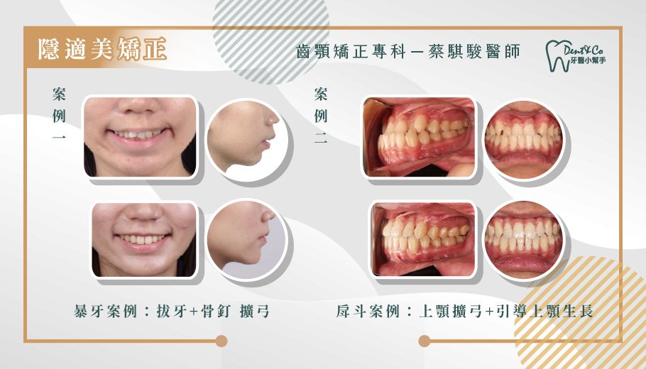 蔡騏駿-案例展示.jpg