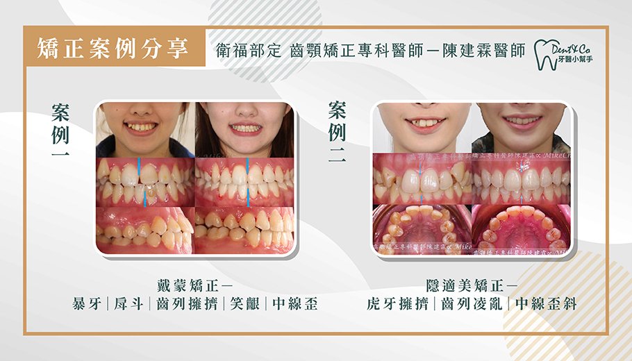 陳建霖醫師矯正案例.jpg