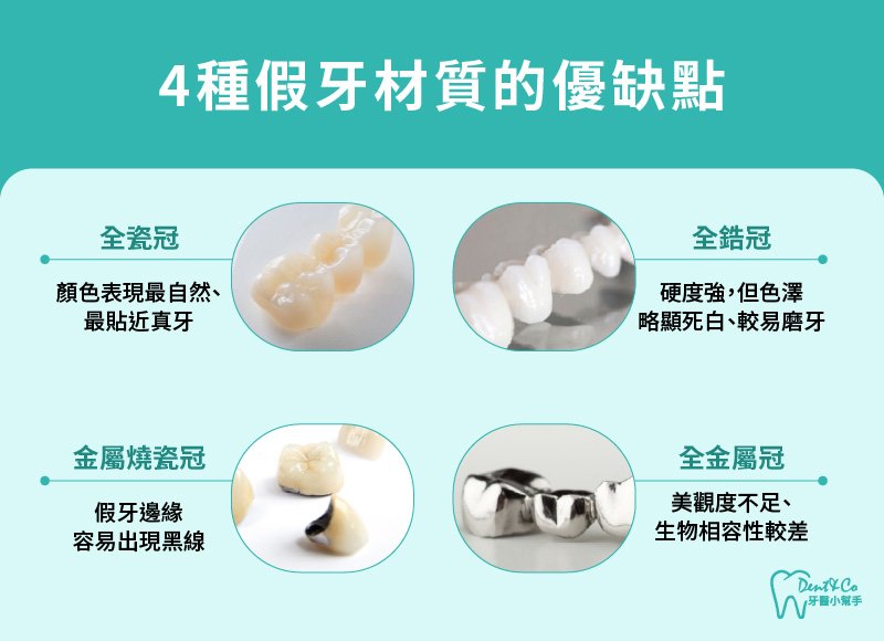 內文圖片-4種假牙材質的優缺點.jpg