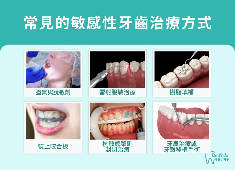內文圖片-常見的敏感性牙齒治療方式.jpg