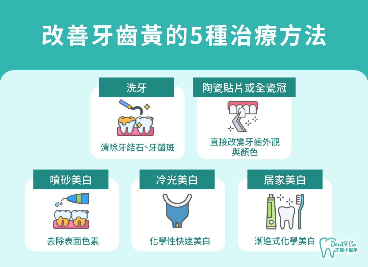 內文圖片-改善牙齒黃的5種治療方法.jpg