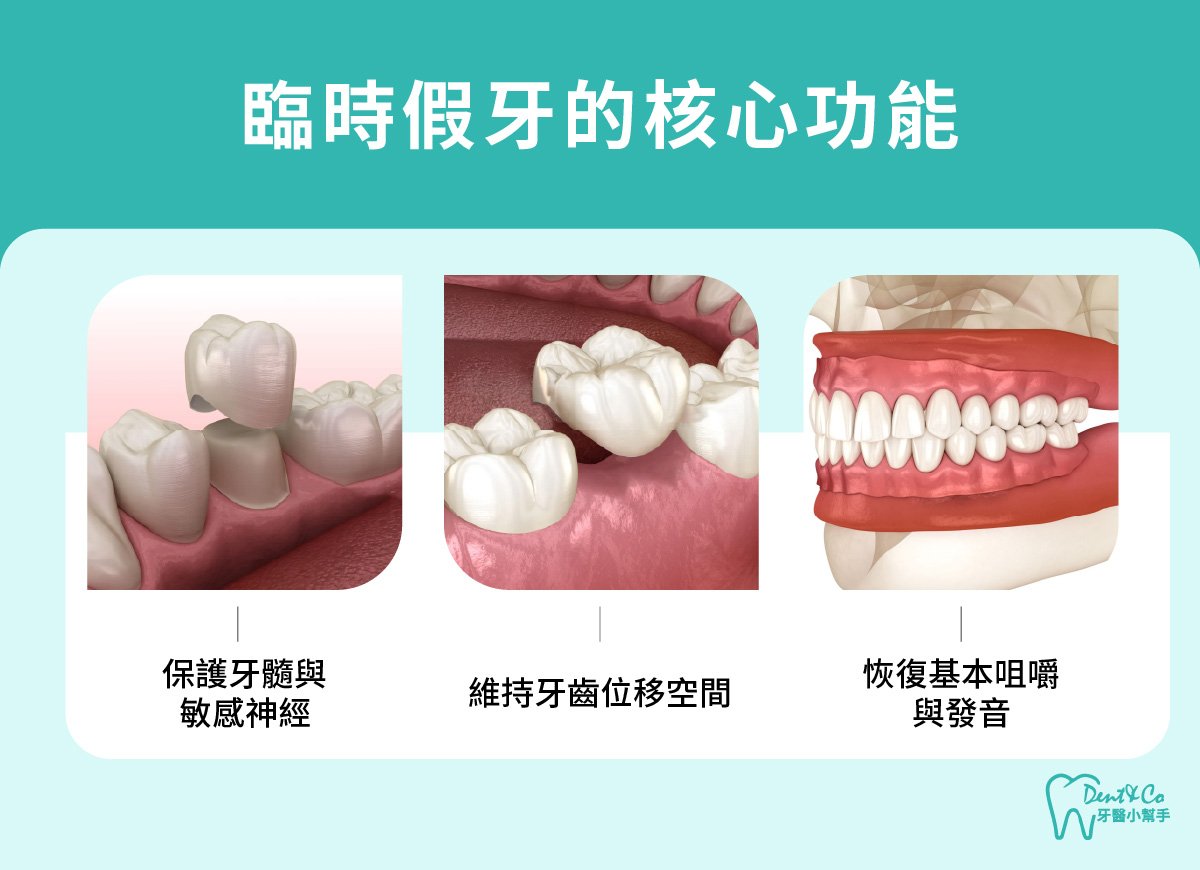 內文圖片-臨時假牙的核心功能.jpg