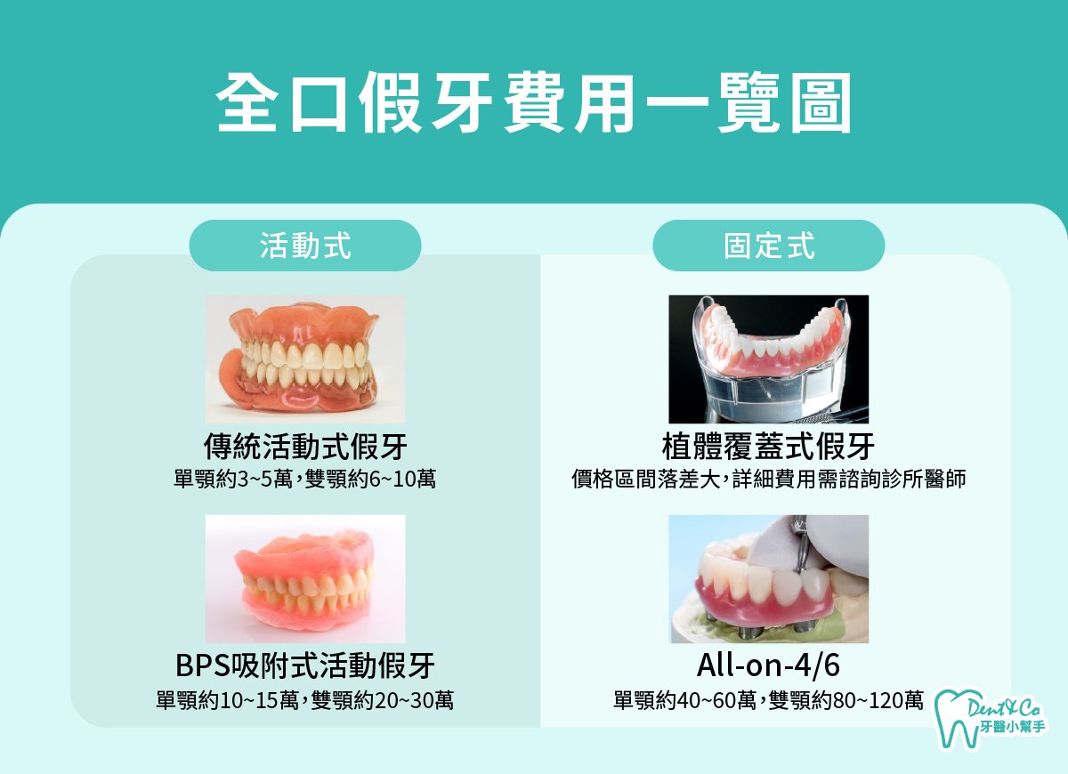 內文圖片-全口假牙費用一覽圖：活動式、固定式.jpg