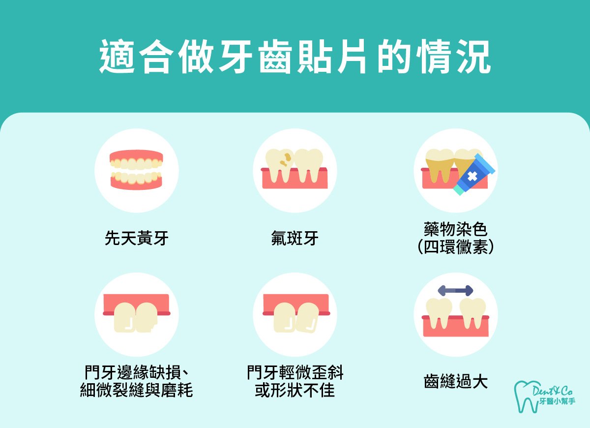 內文圖片-適合做牙齒貼片的情況.jpg