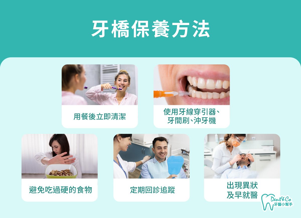 內文圖片-牙橋保養方法.jpg