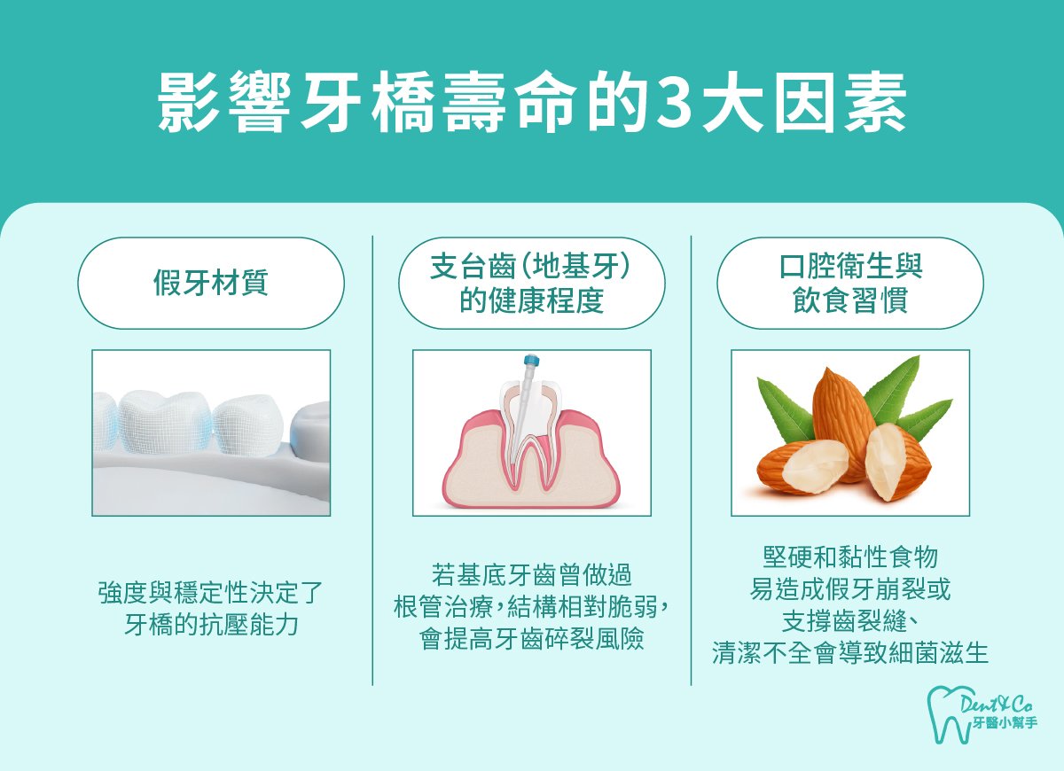 內文圖片-影響牙橋壽命的3大因素.jpg
