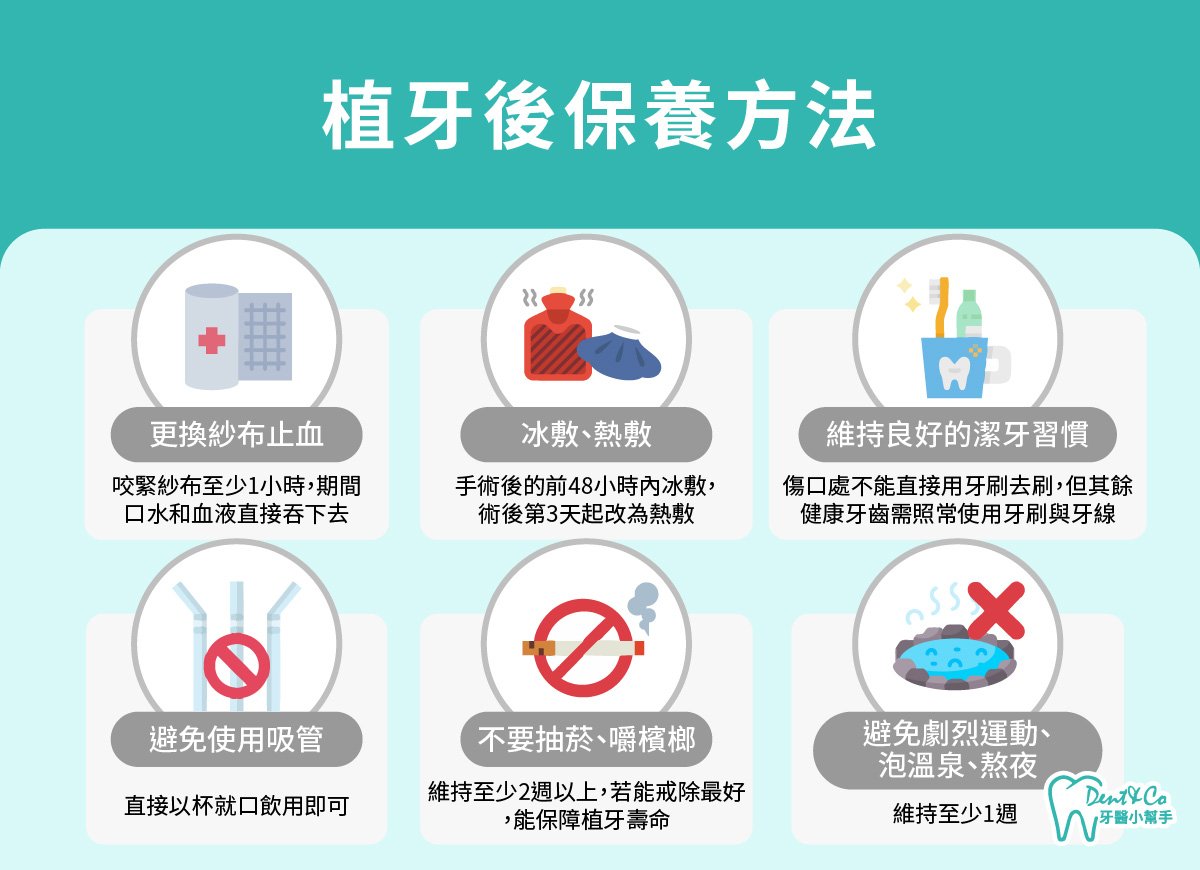 內文圖片-植牙後保養方法.jpg