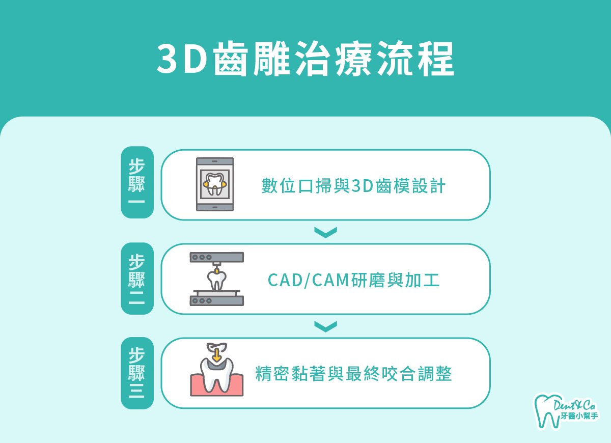 內文圖片- 3D齒雕治療流程.jpg