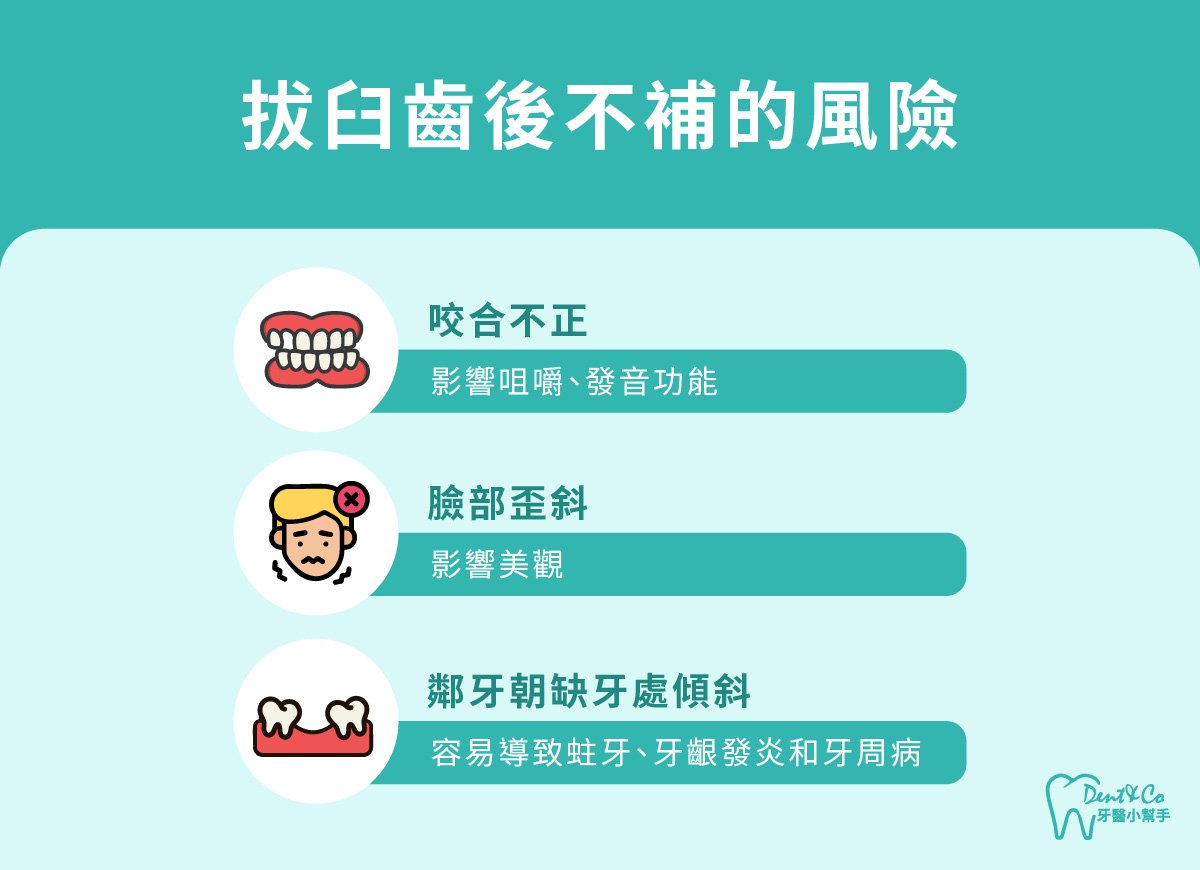 內文圖片- 拔臼齒後不補的風險.jpg