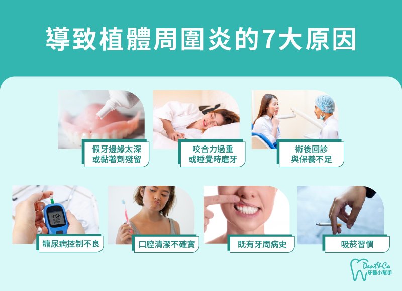 內文圖片- 導致植體周圍炎的7大原因.jpg