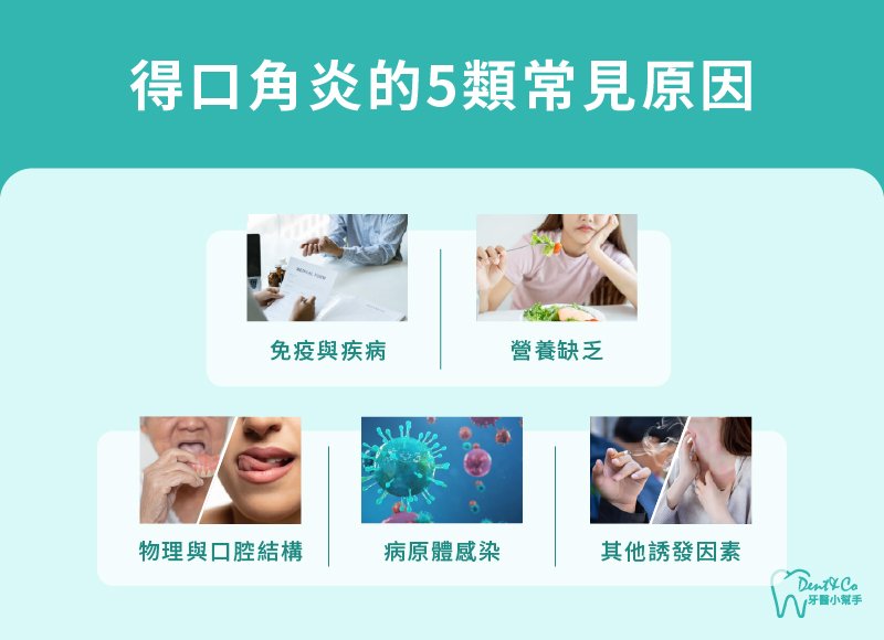 內文圖片- 得口角炎的5類常見原因.jpg