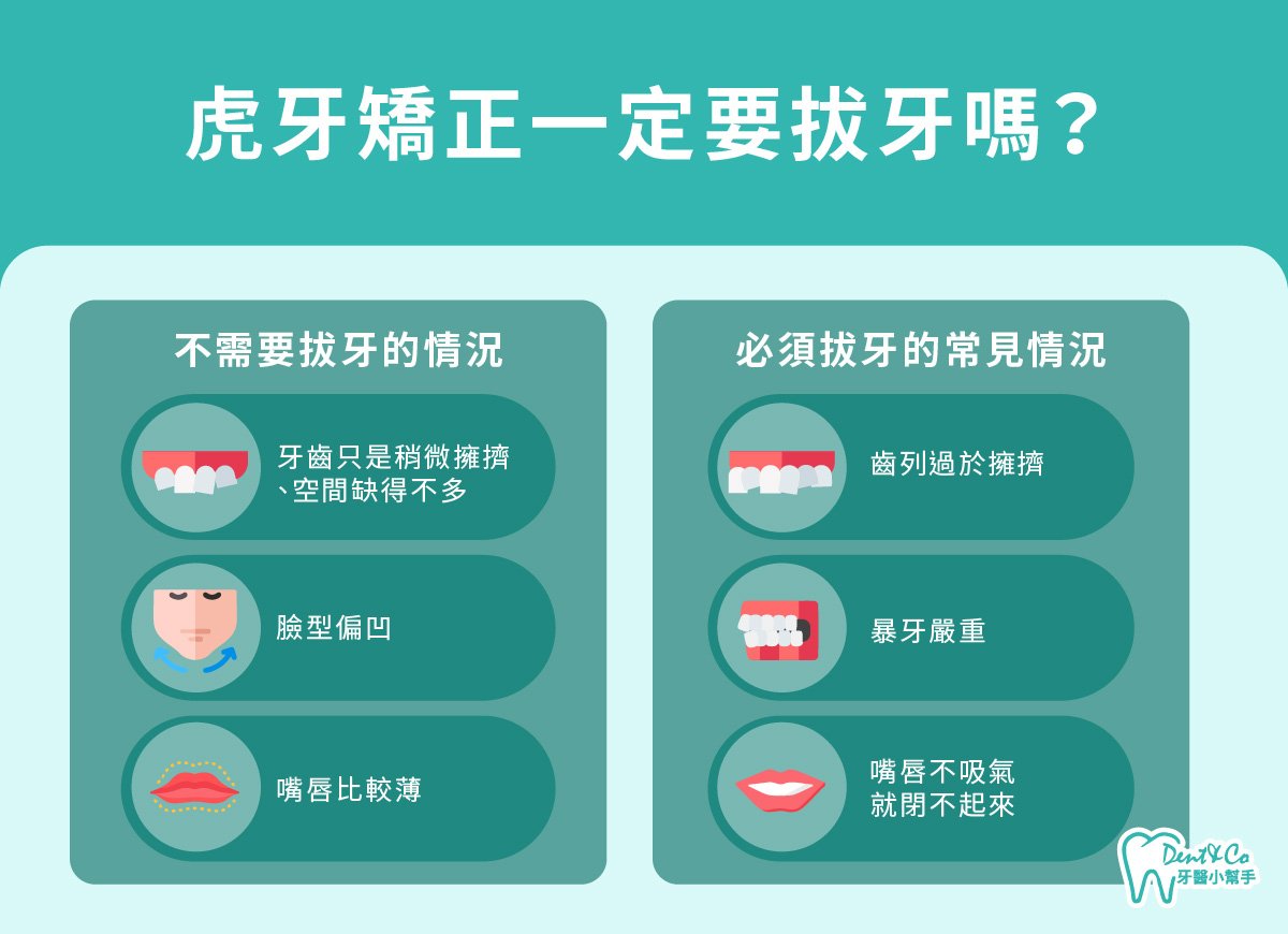 內文圖片- 虎牙矯正一定要拔牙嗎？.jpg