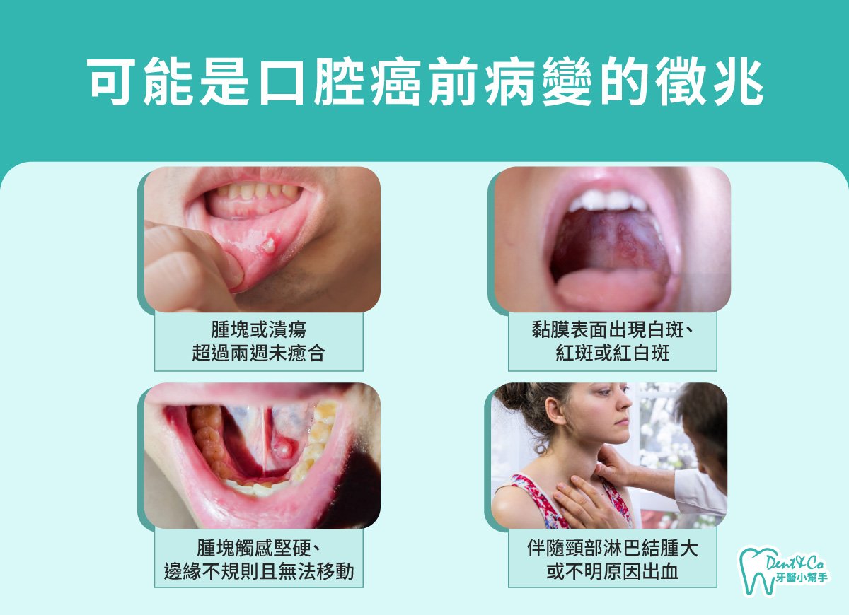 內文圖片- 可能是口腔癌前病變的徵兆.jpg