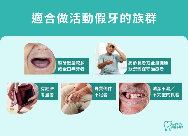 內文圖片- 適合做活動假牙的族群.jpg
