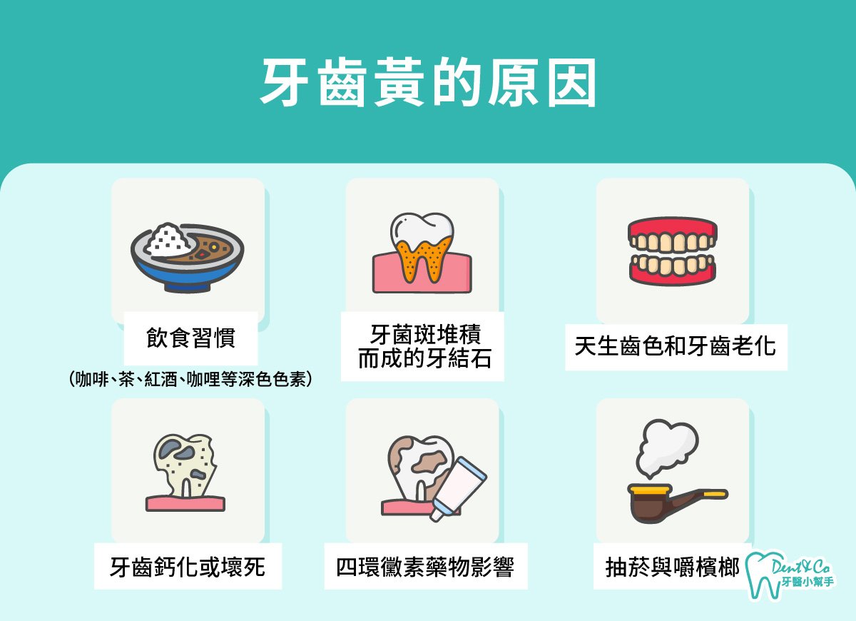 內文圖片- 牙齒黃的原因.jpg