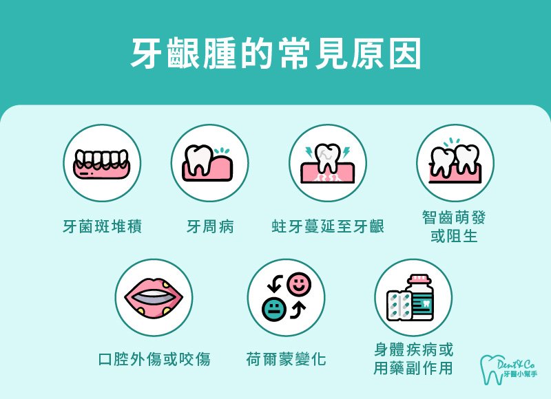 內文圖片- 牙齦腫的常見原因.jpg