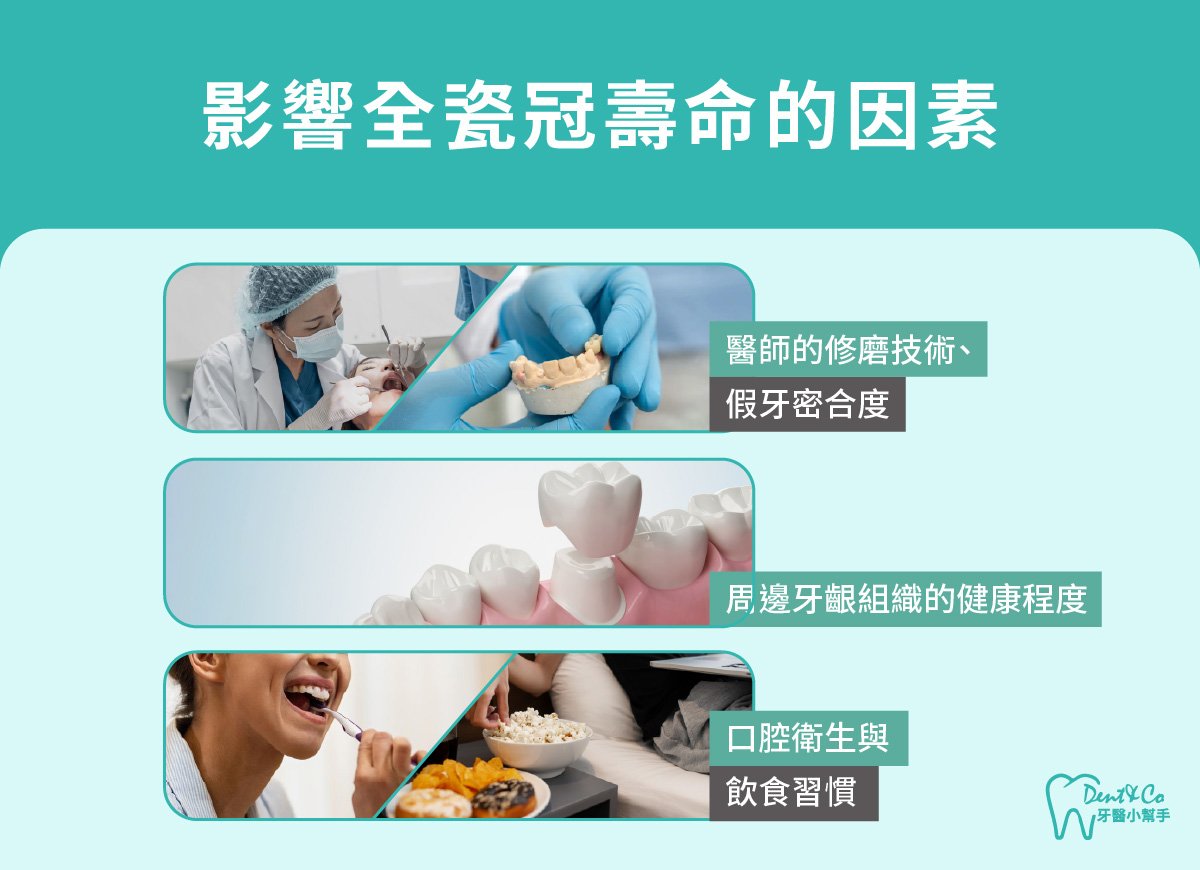 內文圖片- 影響全瓷冠壽命的因素.jpg