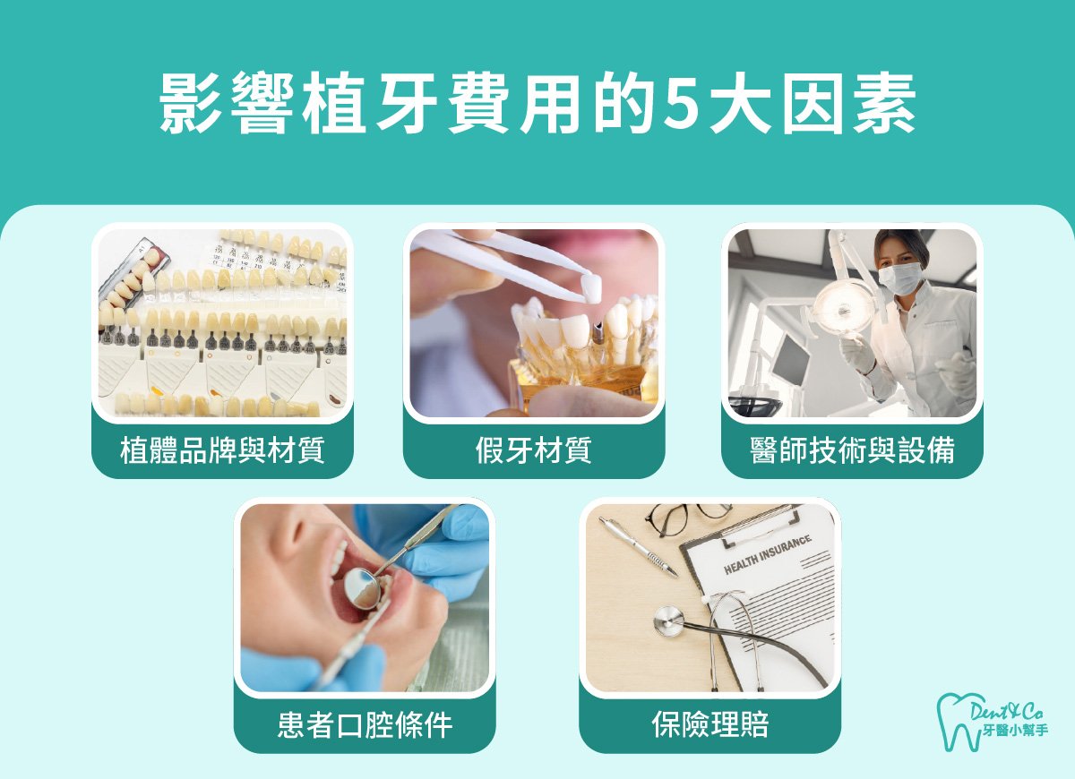內文圖片- 影響植牙費用的5大因素.jpg
