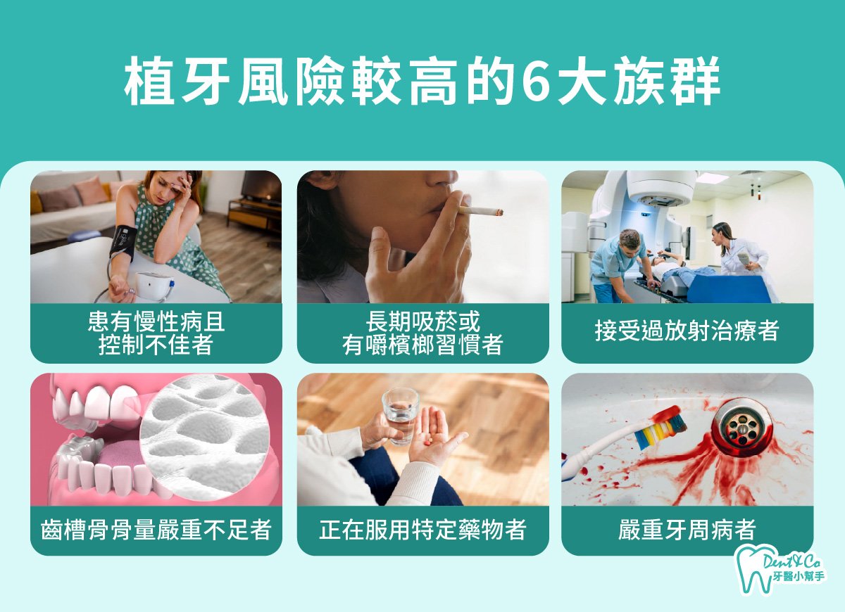 內文圖片- 植牙風險較高的6大族群.jpg