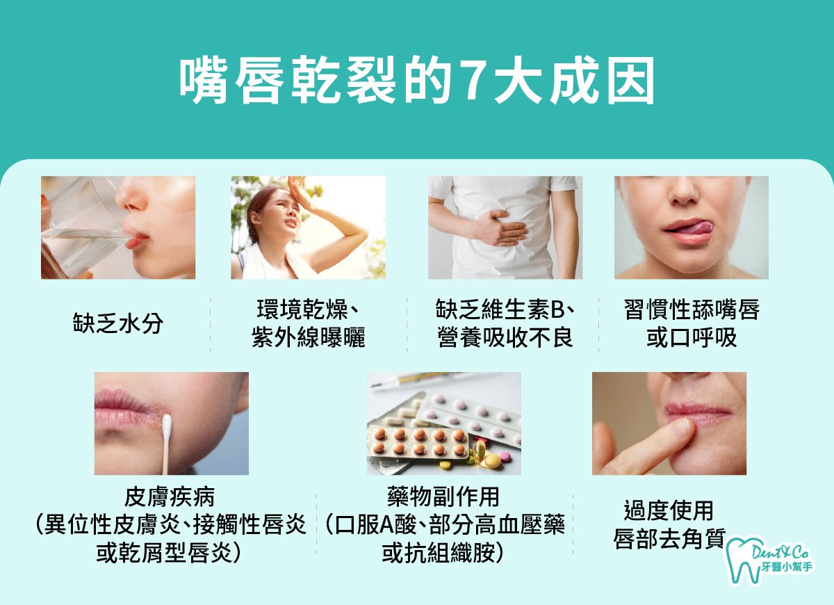 內文圖片- 嘴唇乾裂的7大成因.jpg