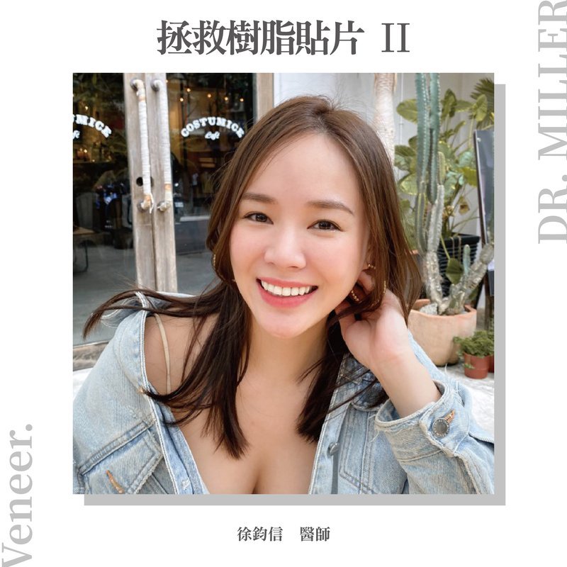 前牙美學案例分享二：拯救樹脂貼片-2.jpg