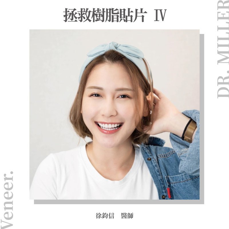 前牙美學案例分享二：拯救樹脂貼片-4.jpg