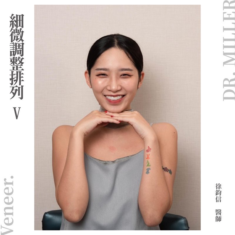 前牙美學案例分享一：細微調整排列-5.jpg