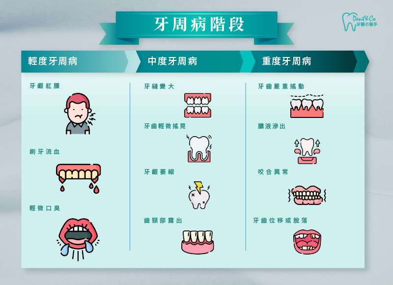 示意圖一-牙周病階段.png
