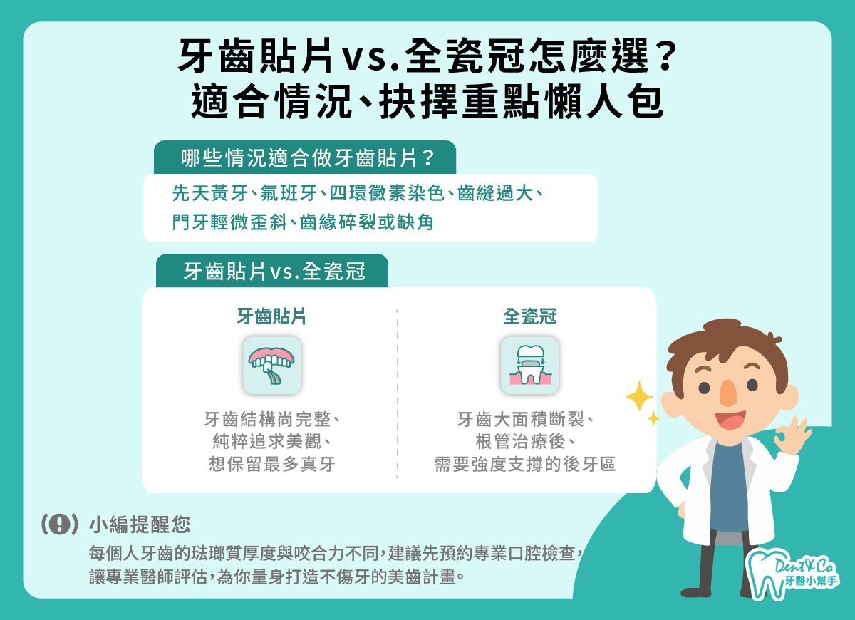 牙齒貼片是什麼?_懶人包.jpg