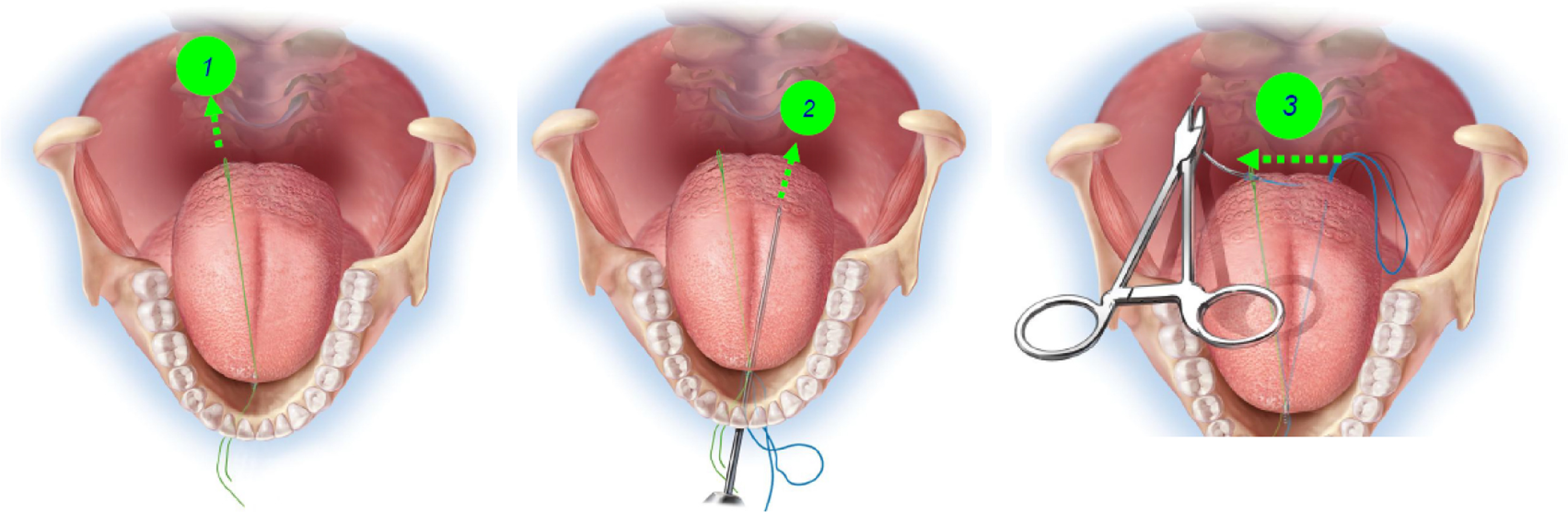 image (2).png