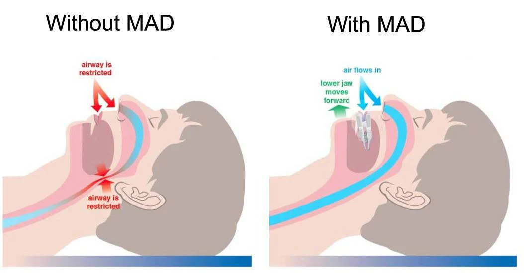 image (2).png