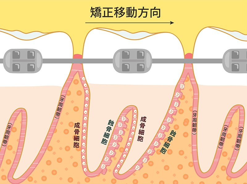 骨重塑機制示意圖。