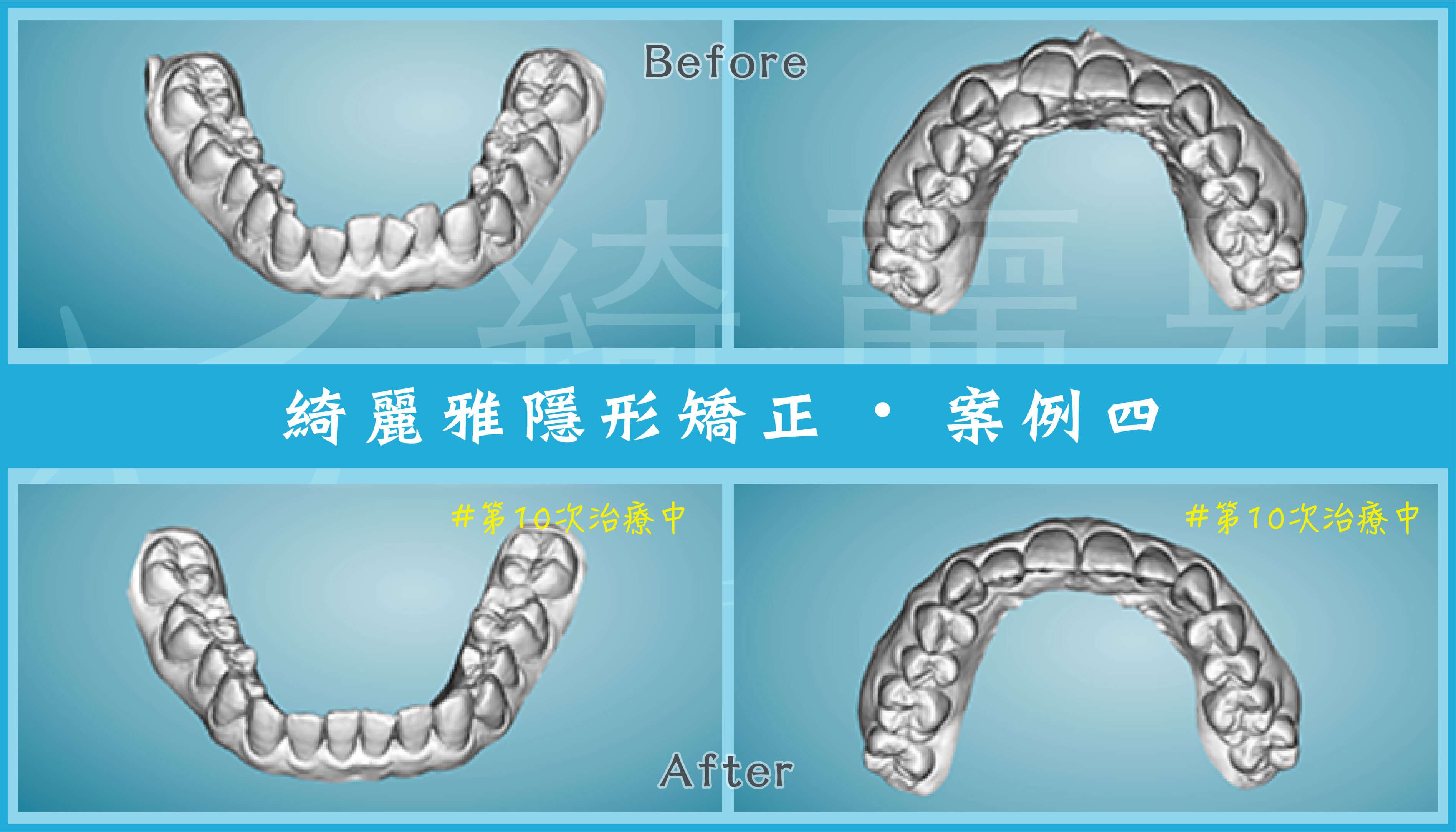 220729_部落格文章2_案例4 (1).jpg