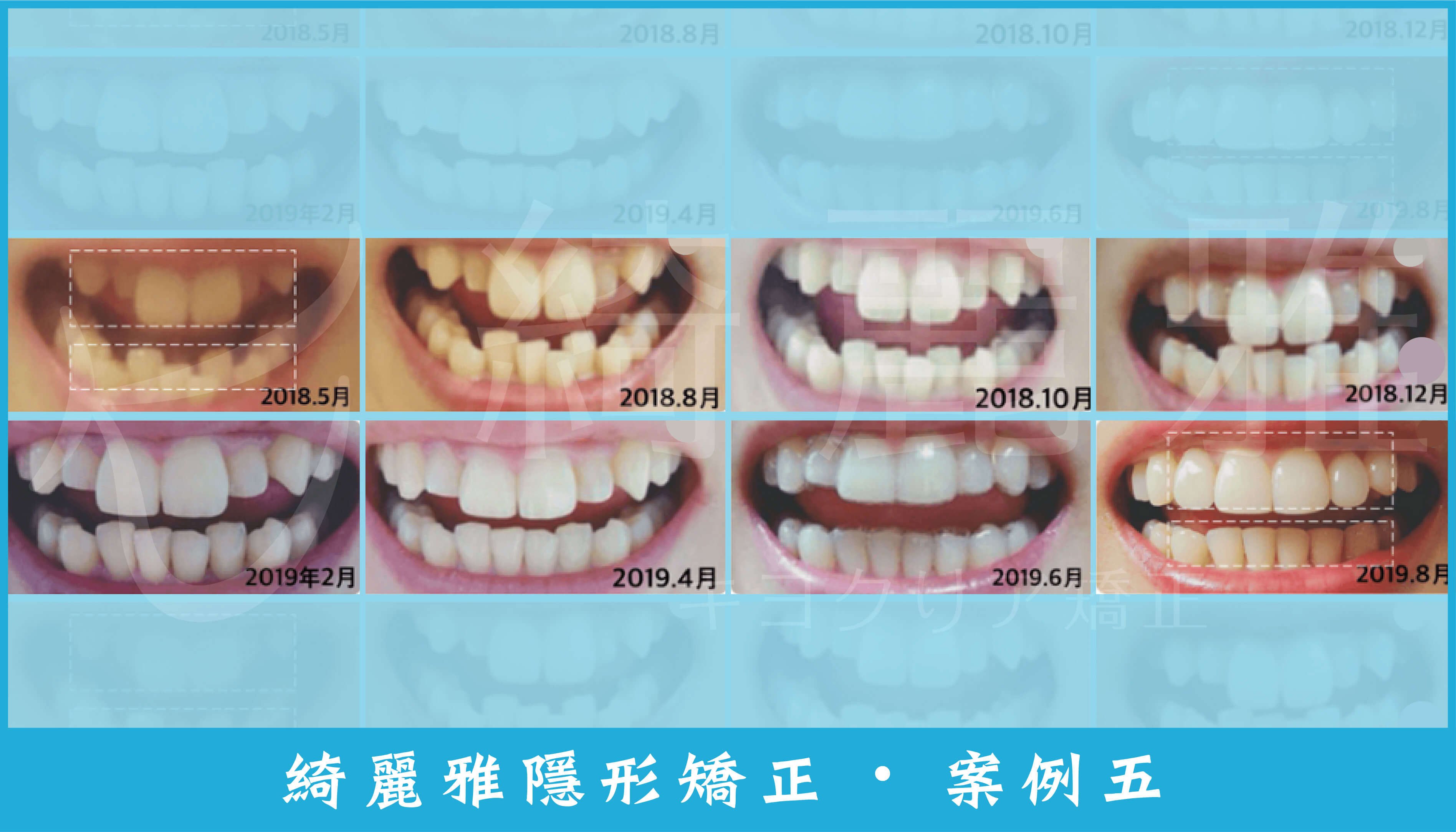 220729_部落格文章2_案例5 (1).jpg