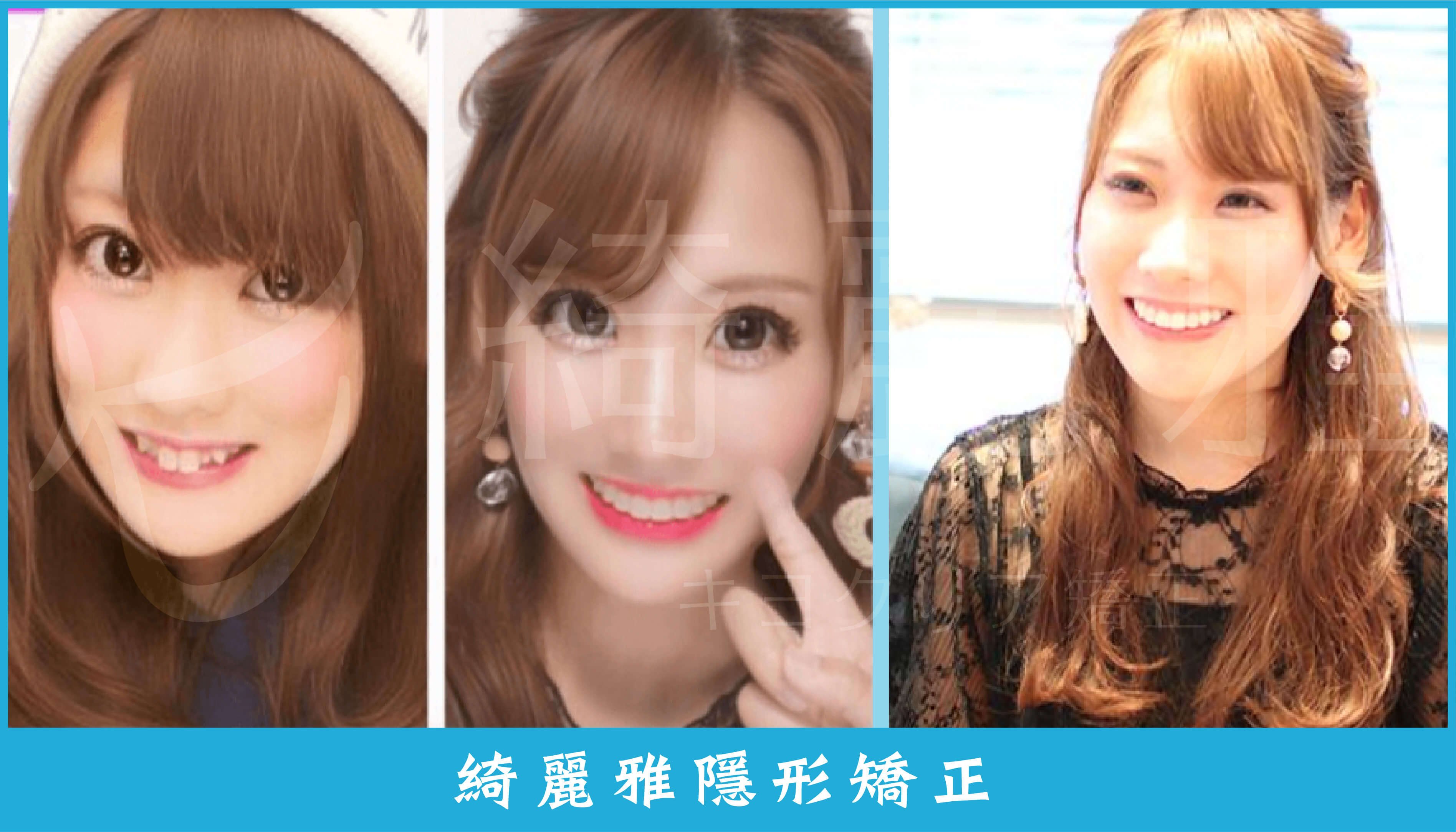 220729_部落格文章2_案例9 (1).jpg