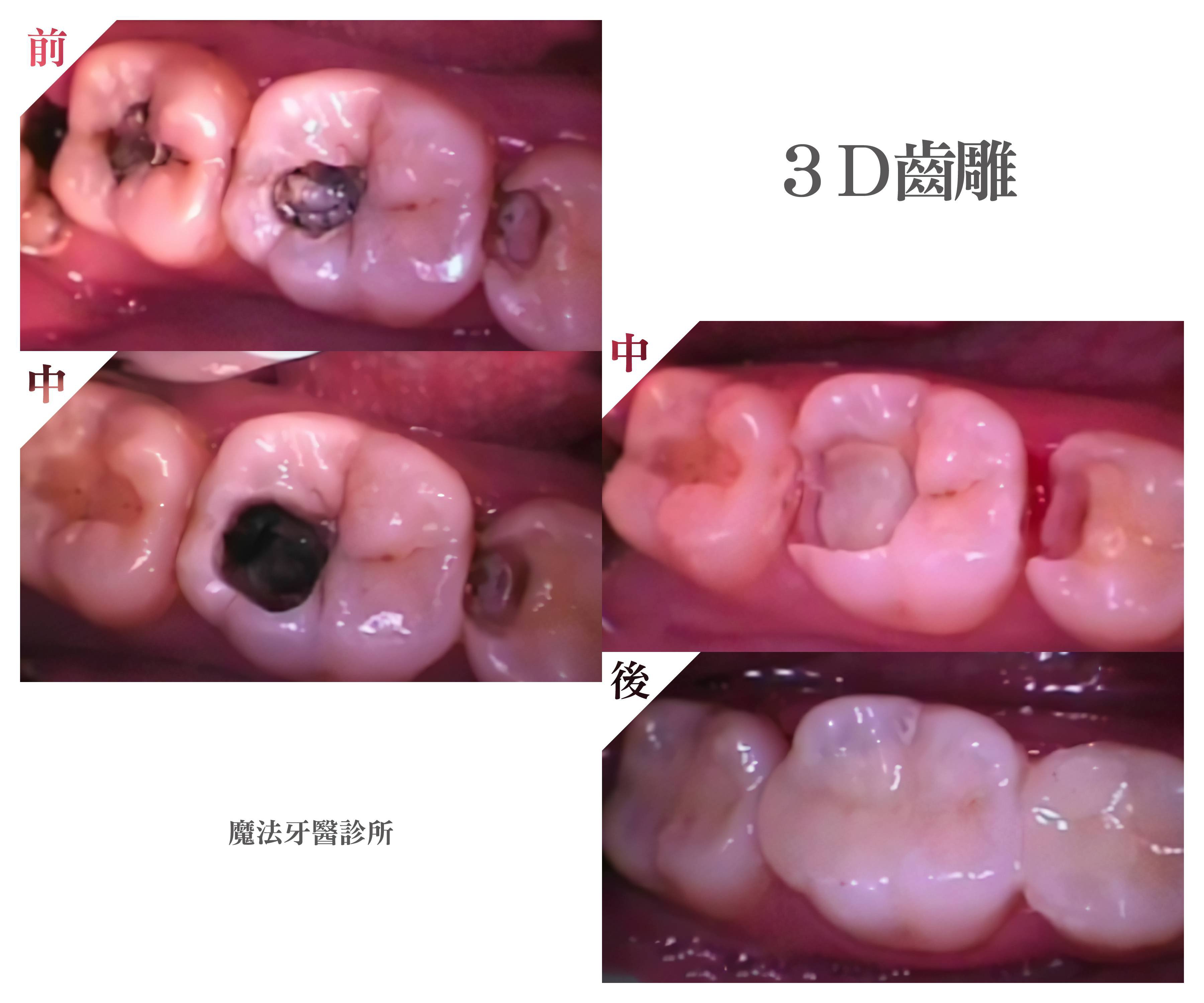 3D齒雕-大圖.jpg