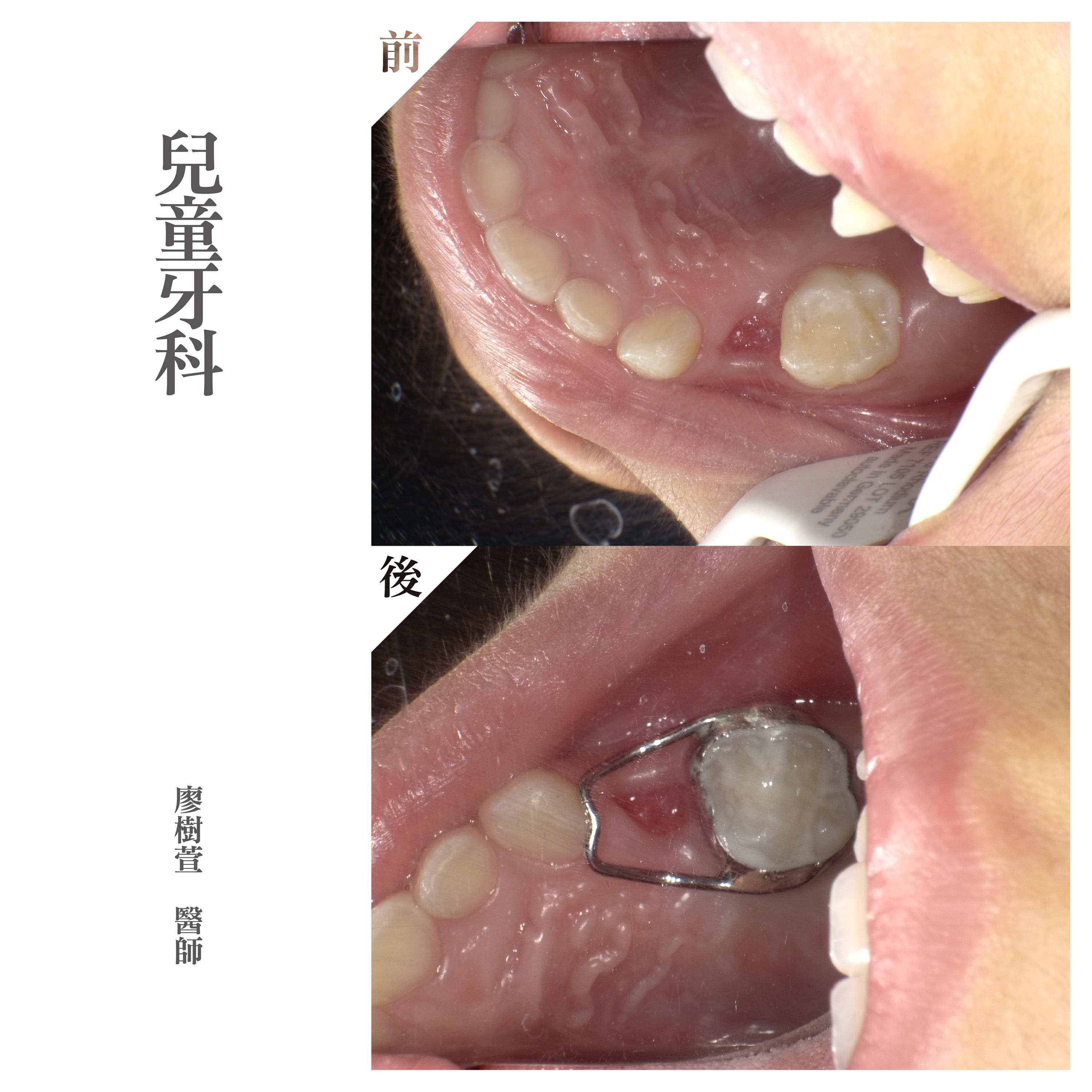 兒童牙醫推薦 - 廖樹萱醫師 .jpg