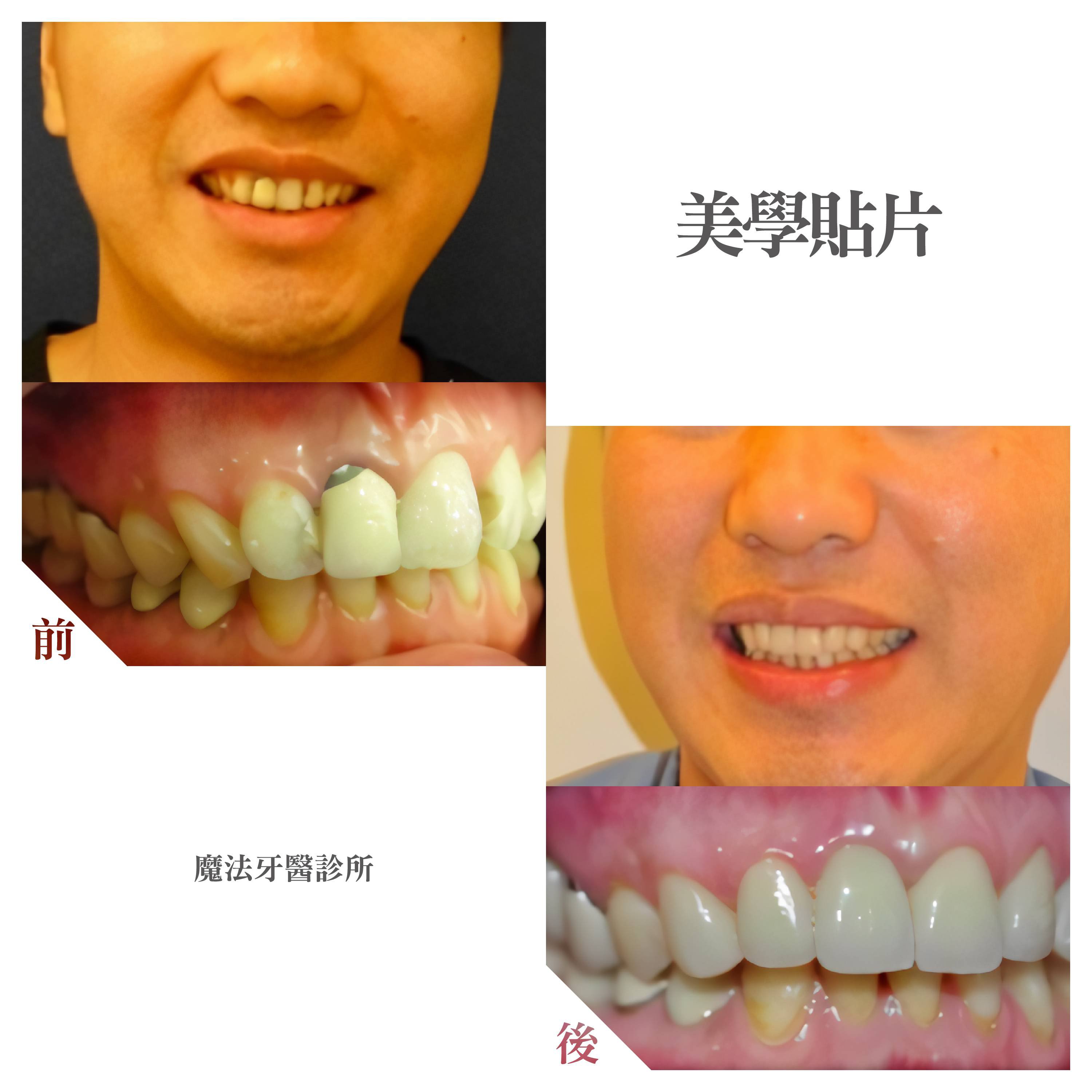 美學貼片-大圖.jpg