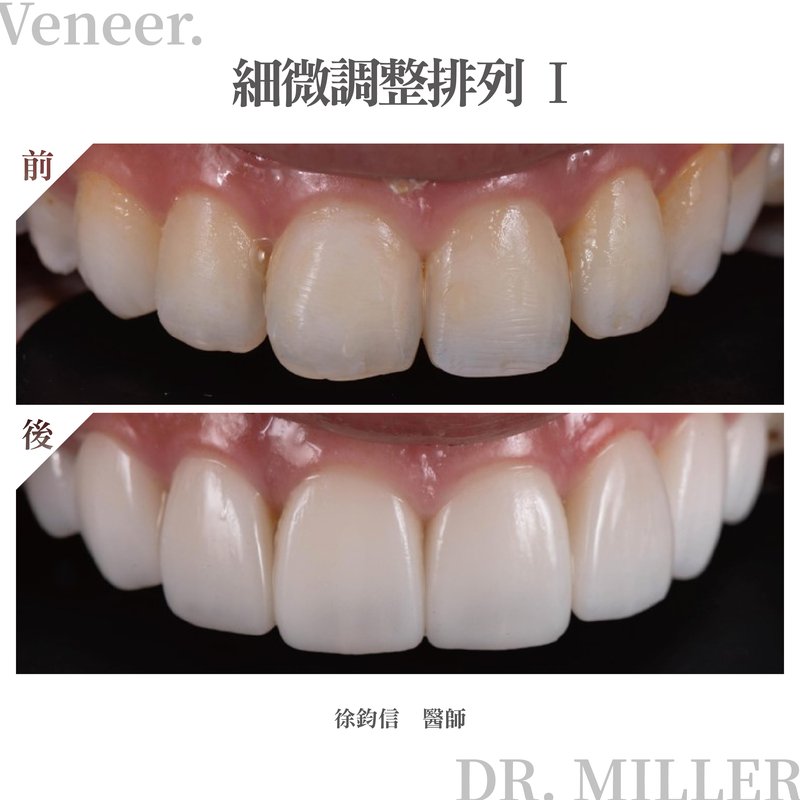 細微調整排列 1.jpg