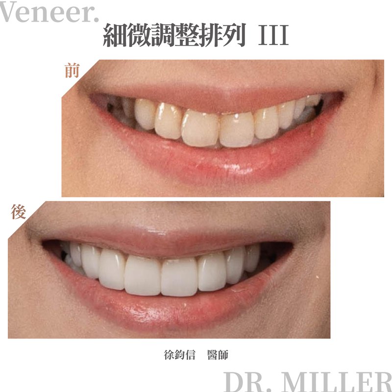 細微調整排列 3.jpg