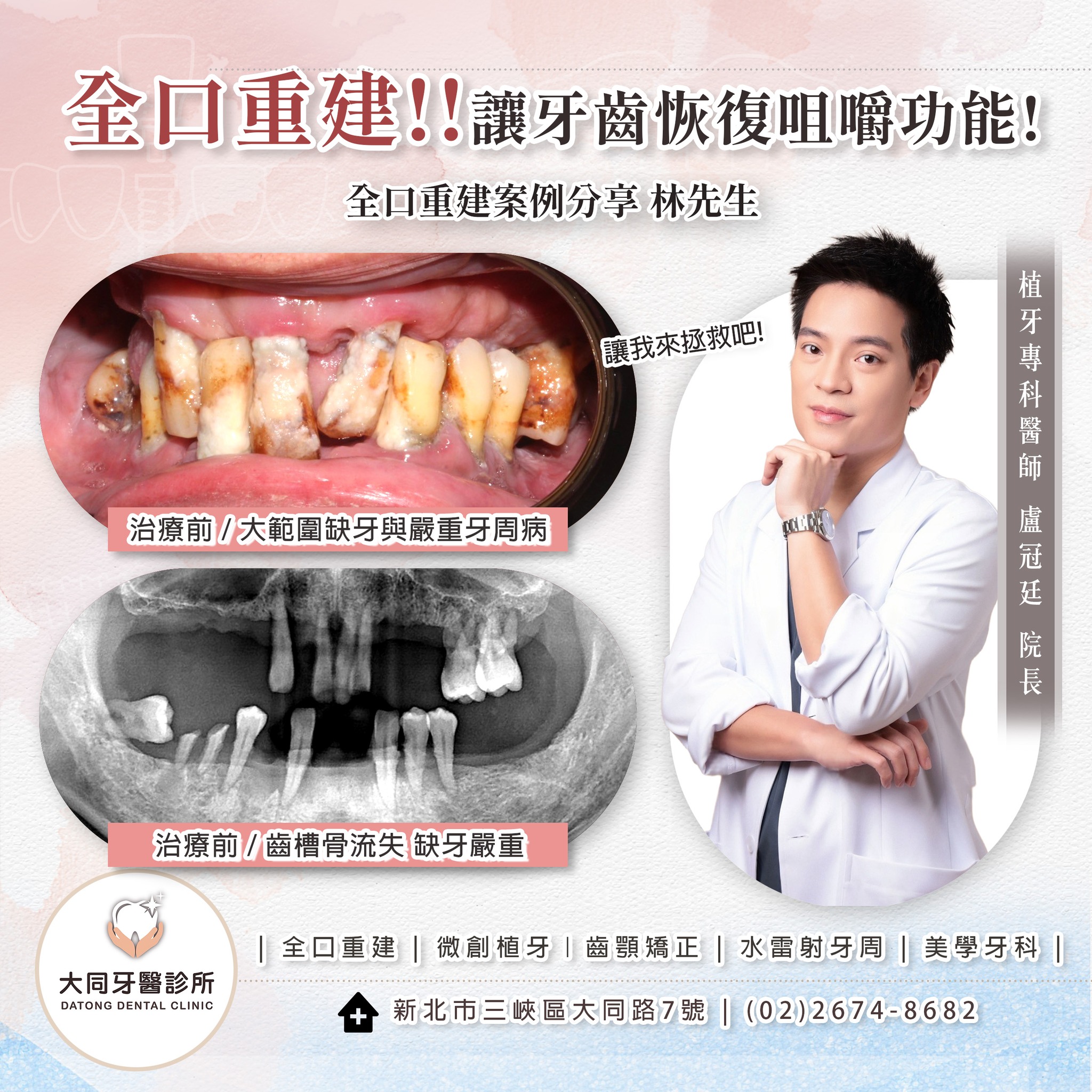 💢我已經好幾年沒辦法好好吃飯了！