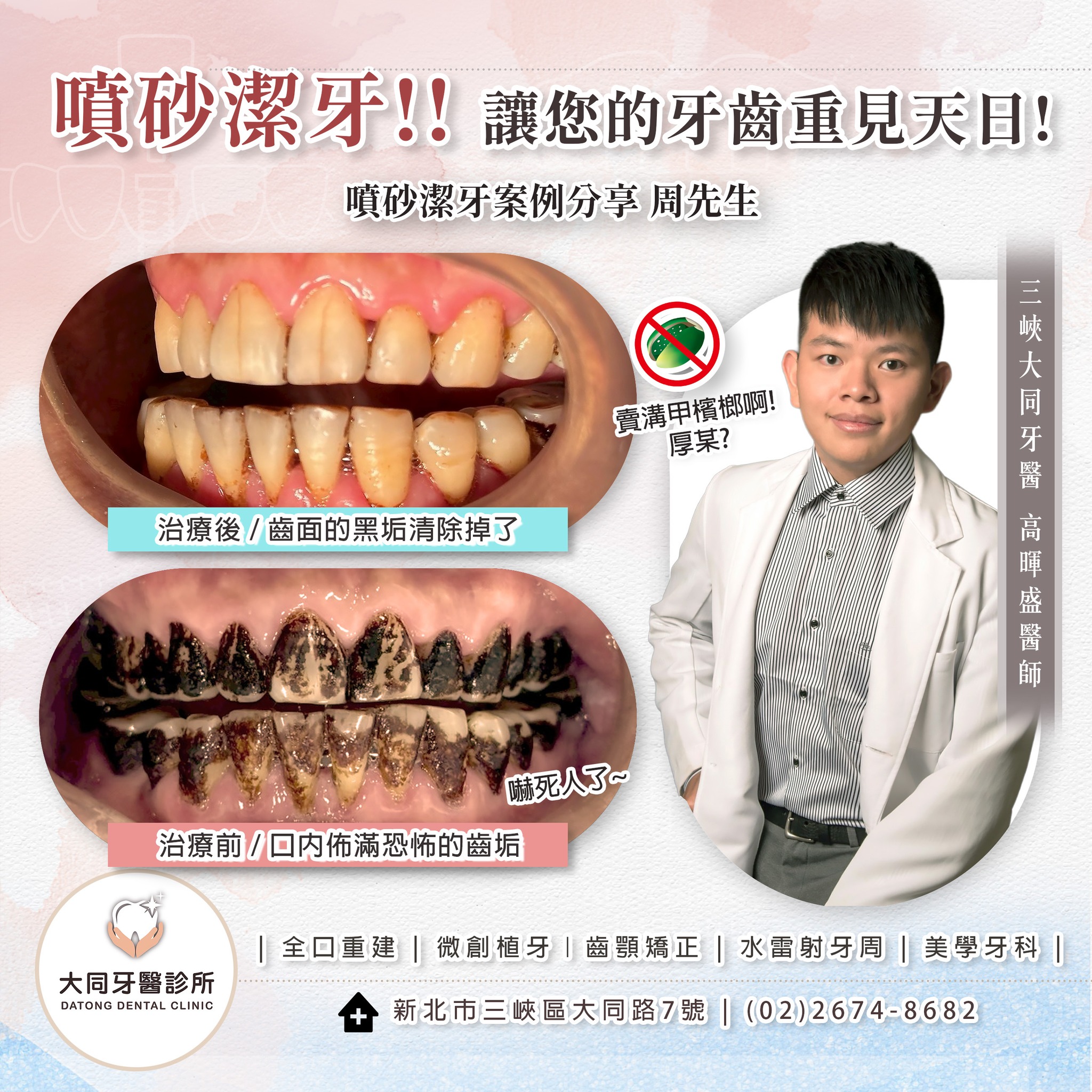 牙齒黑漆漆，到底是發生什麼事了！？